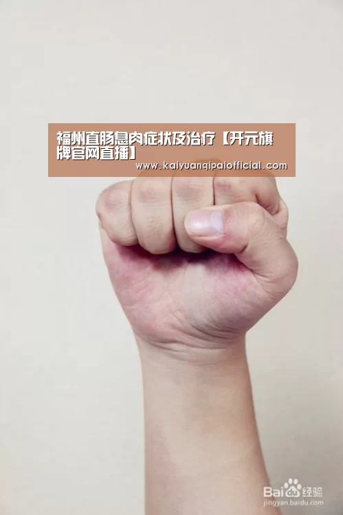福州直肠息肉症状及治疗【开元旗牌官网直播】(图4) 开元旗牌软件